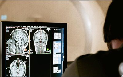 El hospital de Torrevieja inicia el expediente para la licitación de las obras de instalación de un nuevo equipo de resonancia magnética de última generación