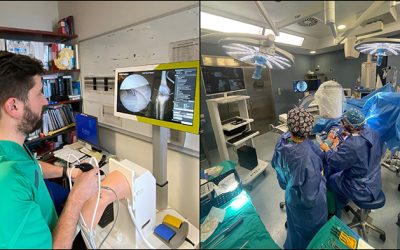 El hospital de Torrevieja pionero en la Comunidad Valenciana en utilizar un navegador de vanguardia para la realización de osteotomías de rodilla